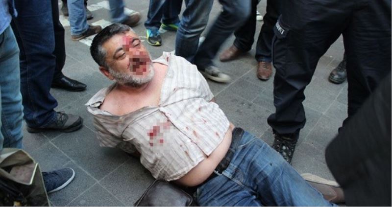  Polis Gazetecinin Burnunu Kırıp Gözaltına aldı...